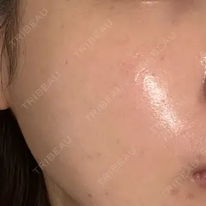 BBC BBC表参道院口コミ