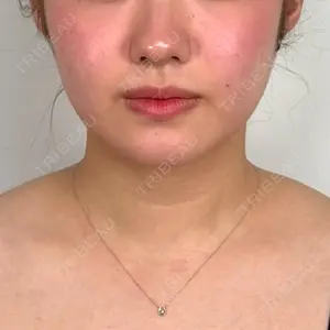 口コミ