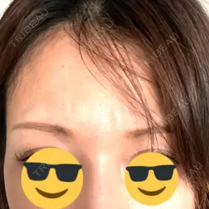 TCB東京中央美容外科 TCB東京中央美容外科 神戸院口コミ