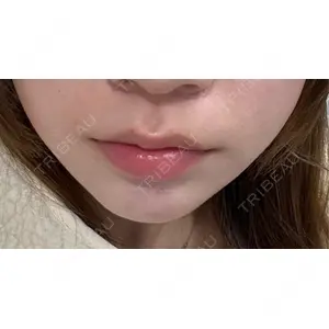 ルラ美容クリニック ルラ美容クリニック 渋谷本院口コミ
