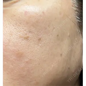 東京美容皮膚科アロエクリニック 東京美容皮膚科アロエクリニック池袋口コミ