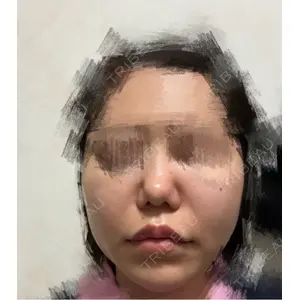 TCB東京中央美容外科 TCB東京中央美容外科 高崎院口コミ