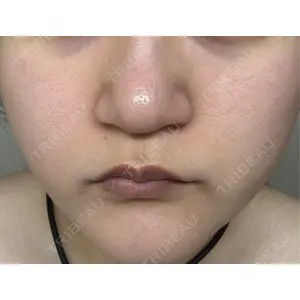 東京美容皮膚科アロエクリニック 東京美容皮膚科アロエクリニック池袋口コミ