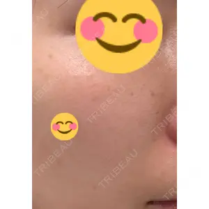 APスキンクリニック銀座口コミ