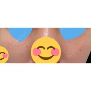 APスキンクリニック銀座口コミ