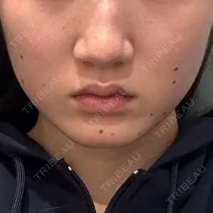 アリエル美容クリニック アリエル美容クリニック 大宮院口コミ