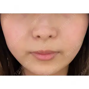 おおたかの森ビューティークリニック おおたかの森ビューティークリニック口コミ