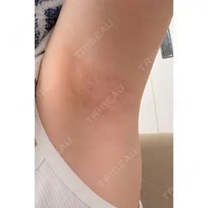 白金ビークリニック 本院口コミ