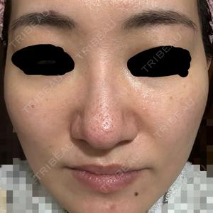ブリリアスキンクリニック口コミ