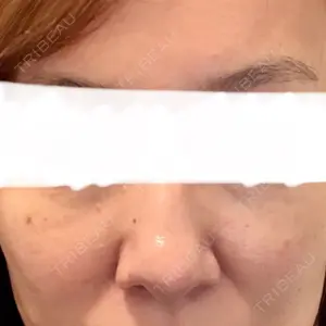 東京美容皮膚科アロエクリニック 東京美容皮膚科アロエクリニック池袋口コミ