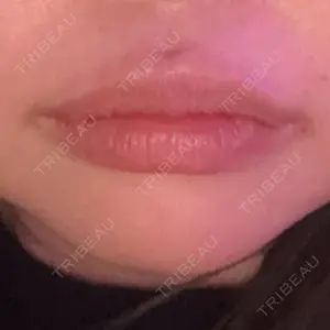 ルラ美容クリニック ルラ美容クリニック 大阪心斎橋院口コミ