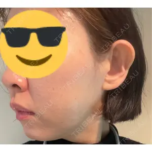 南青山コスメクリニック口コミ