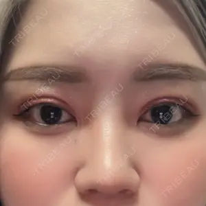 LUHO（ルホ）美容外科口コミ