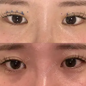 ルラ美容クリニック ルラ美容クリニック 名古屋本院口コミ