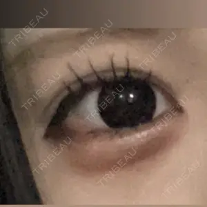 TCB東京中央美容外科 TCB東京中央美容外科 なんば院口コミ