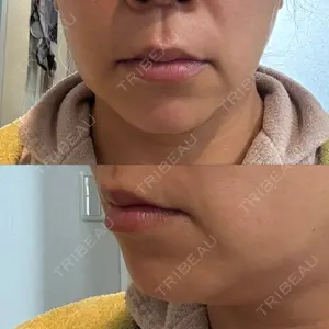 BLINC CLINIC （ブリンク クリニック）口コミ