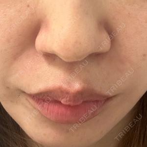 NARU Beauty Clinic NARU Beauty Clinic 【ナルクリ】口コミ
