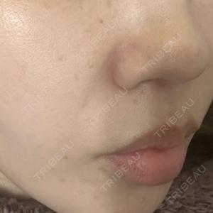 NARU Beauty Clinic NARU Beauty Clinic 【ナルクリ】口コミ