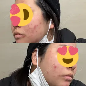トラスト美容クリニック トラスト美容クリニック 銀座院口コミ