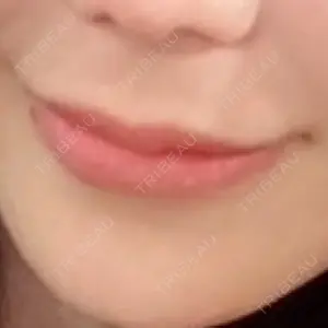 ルラ美容クリニック ルラ美容クリニック 名古屋本院口コミ