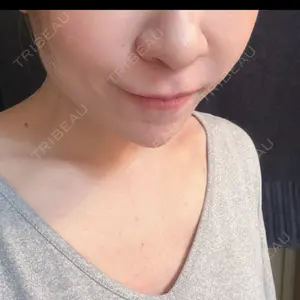 新宿美容外科クリニック 新宿美容外科クリニック 新宿院口コミ