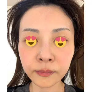 口コミ