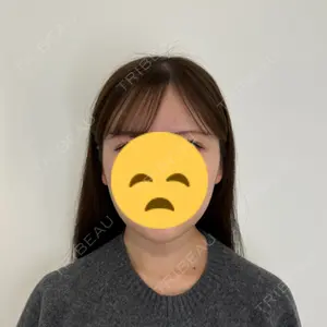 美容皮膚科ティファクリニック 美容皮膚科ティファクリニック 新宿東口口コミ