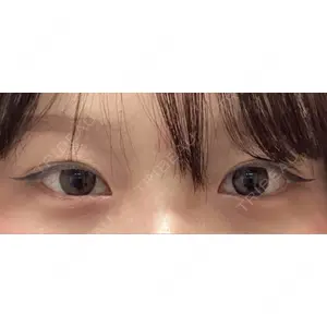 AYANAフィラーズクリニック AYANAフィラーズクリニック 渋谷院口コミ