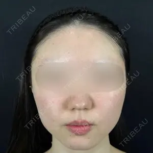 藤・ナチュレ美容クリニック 藤・ナチュレ美容クリニック 銀座院口コミ