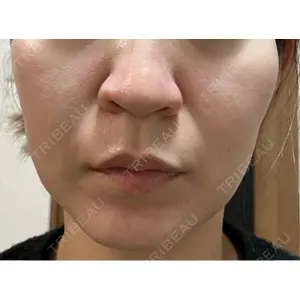 美容皮膚科ティファクリニック 美容皮膚科ティファクリニック 横浜院口コミ