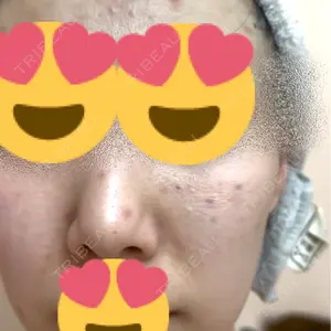 APスキンクリニック銀座口コミ