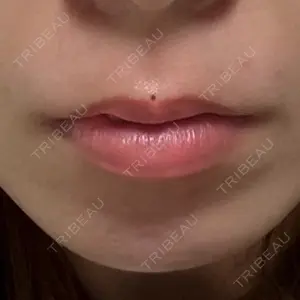 美容皮膚科ティファクリニック 美容皮膚科ティファクリニック 新宿東口口コミ