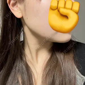 HINATA クリニック口コミ