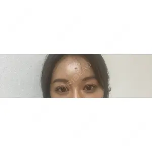 HAAB CLINIC HAAB BEAUTY CLINIC 名古屋院口コミ