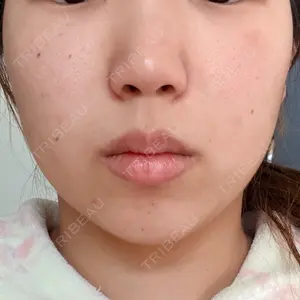 ビラビューティークリニック 小倉美容外科/美容皮膚科 ビラビューティークリニック口コミ