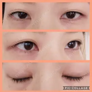 有楽町高野美容クリニック口コミ