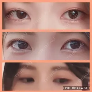 有楽町高野美容クリニック口コミ
