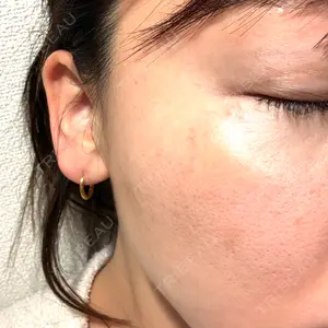 やさしい美容皮膚科・皮フ科 やさしい美容皮膚科・皮フ科　秋葉原院口コミ