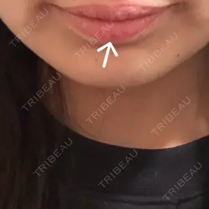 さっぽろ美容クリニック口コミ