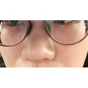 やさしい美容皮膚科・皮フ科 やさしい美容皮膚科・皮フ科　秋葉原院口コミ