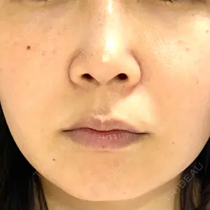 おおたかの森ビューティークリニック おおたかの森ビューティークリニック口コミ