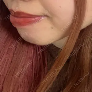 口コミ