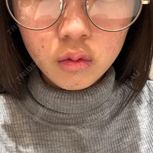 BITO BEAUTY CLINIC BITO BEAUTY CLINIC口コミ