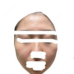 BITO BEAUTY CLINIC BITO BEAUTY CLINIC口コミ