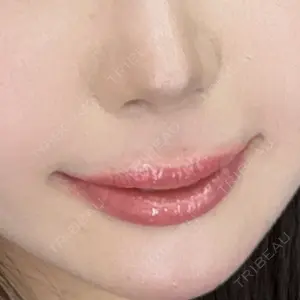 HAAB CLINIC HAAB×DREAM BEAUTY CLINIC 東京本院口コミ