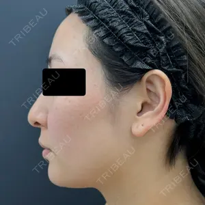 BLINC CLINIC （ブリンク クリニック）口コミ