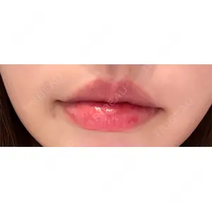 プロクリニック PRO CLINIC プロクリニック 銀座院口コミ