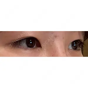 LUHO（ルホ）美容外科口コミ