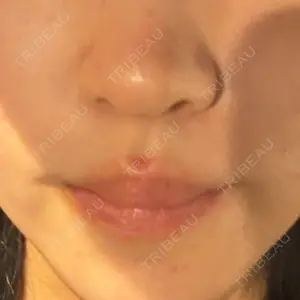 HAAB CLINIC HAAB×DREAM BEAUTY CLINIC 大阪梅田院口コミ