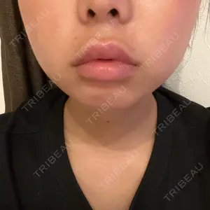 HAAB CLINIC HAAB×DREAM BEAUTY CLINIC 東京本院口コミ